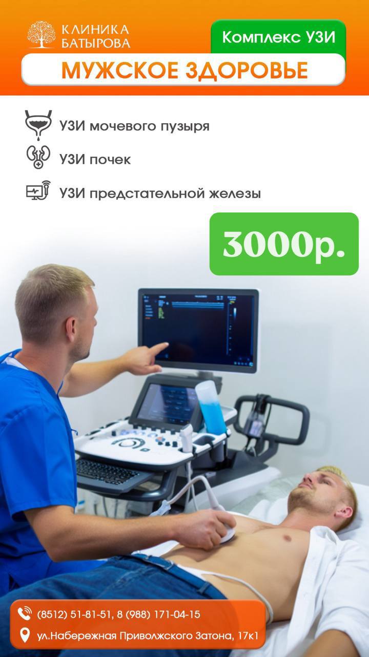 Акция 14